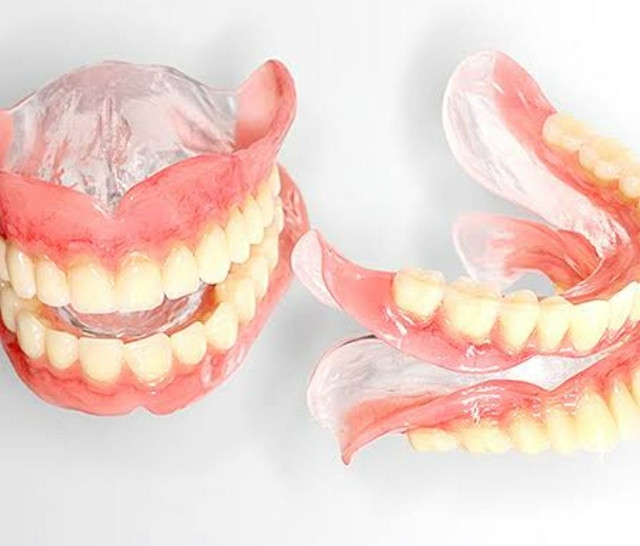 Ponte móvel ,dentadura ,ponte com grampo e protese de silicone ,a partir de 400 - Foto 4