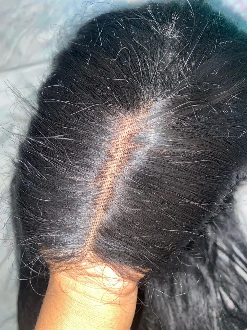 Peruca Lace Frontal Sintética Preta 26 Polegadas - Pouco Usada - Foto 2