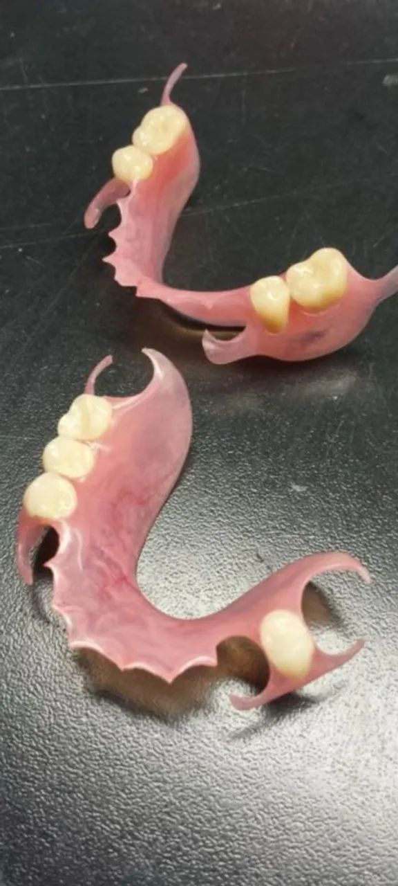 Dente Prótese Dentária  - Foto 5