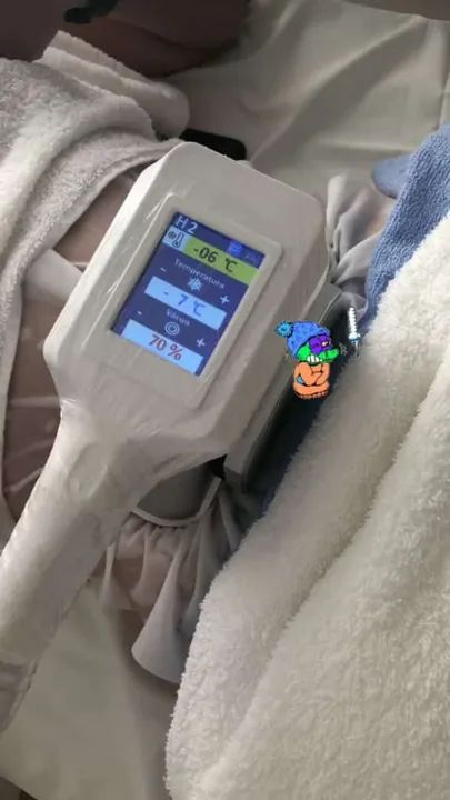 Criolipolise Asgard 360 - Foto 4