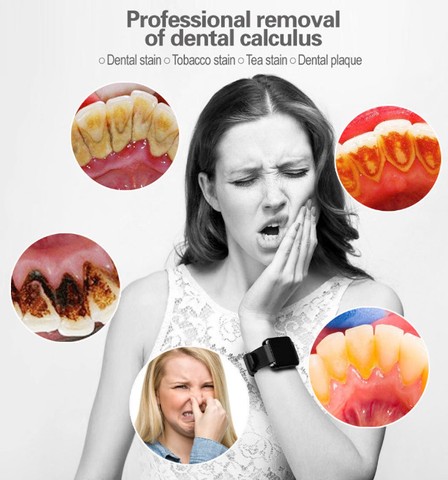 Escova Dental Elétrica e Removedor De Tártaro Raspador  - Foto 2