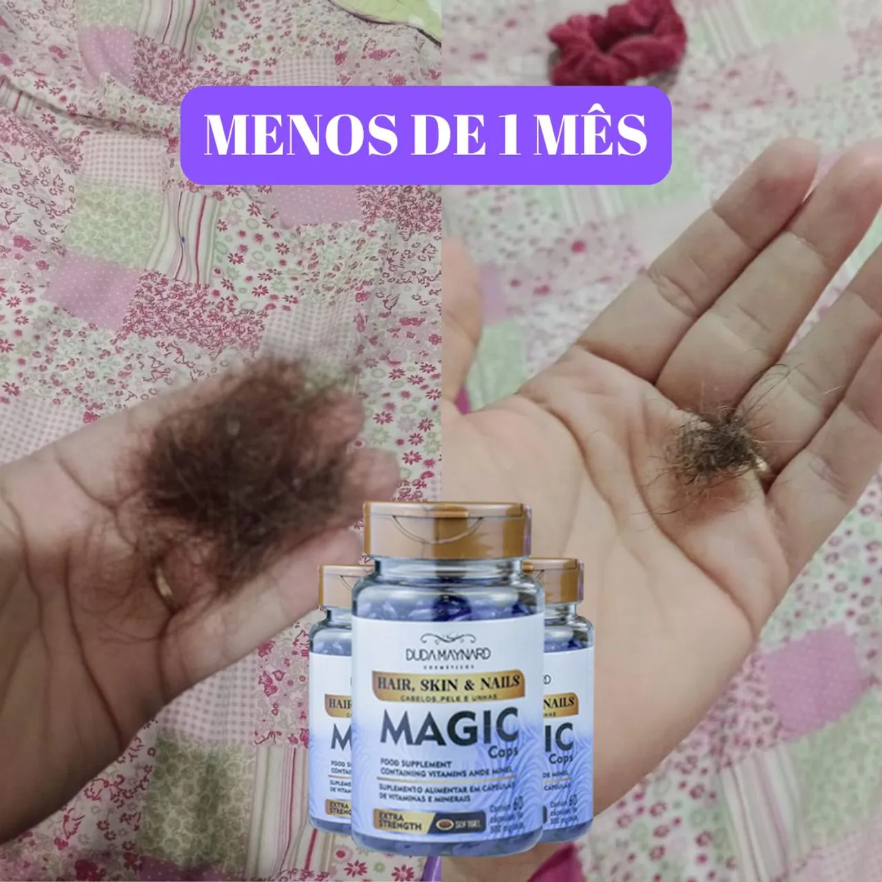 Magic Caps - Queda de cabelo nunca mais!
