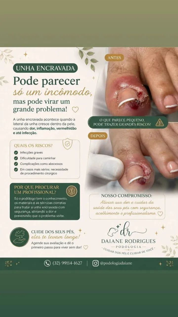 Serviço de podologia domiciliar e clínica  - Foto 4