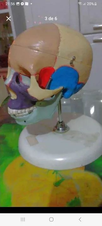 Crânio   humano para estudos  de material simulante a osso ,aceito  trocas 64650960423683120