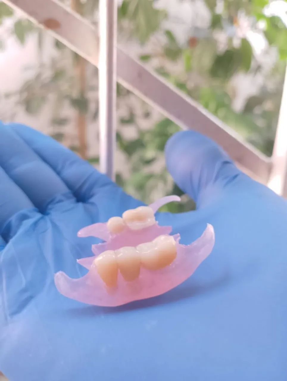 Prótese dentária  - Foto 4