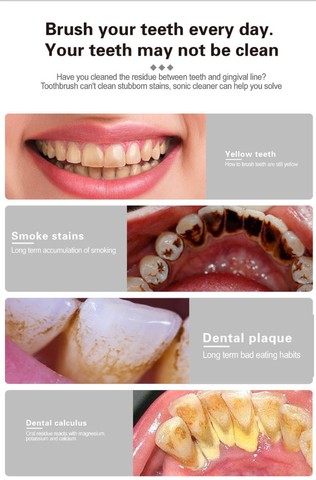 Escova Dental Elétrica e Removedor De Tártaro Raspador  - Foto 6