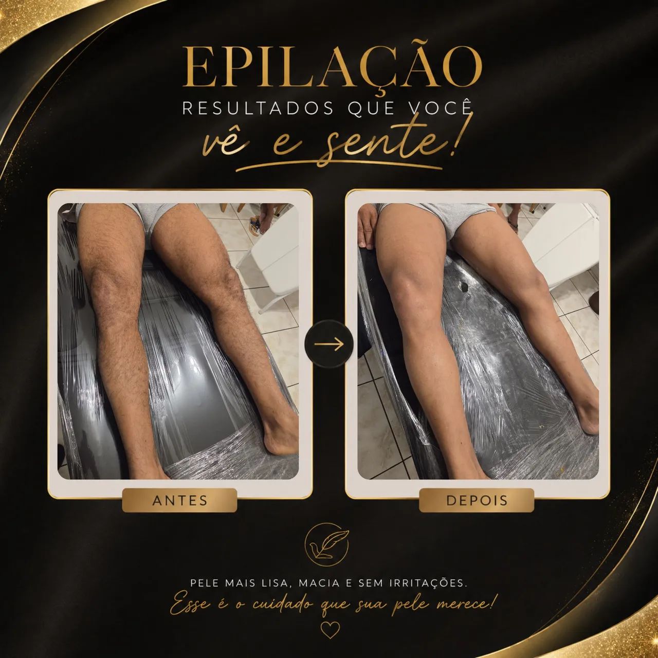 Depilação com cera - Foto 2