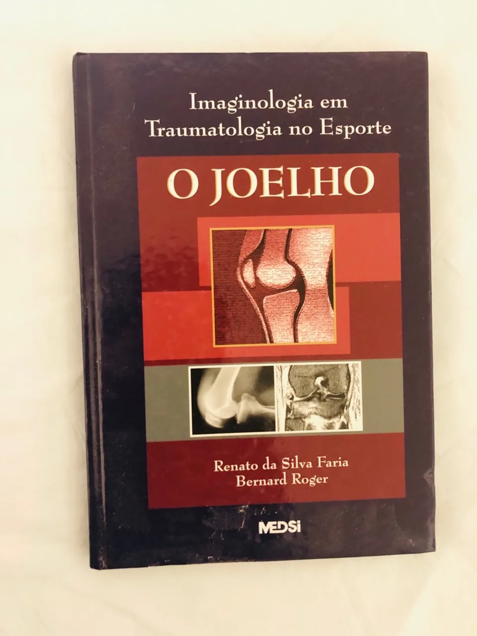 Livro Imaginologia em Traumatologia no Esporte - O Joelho