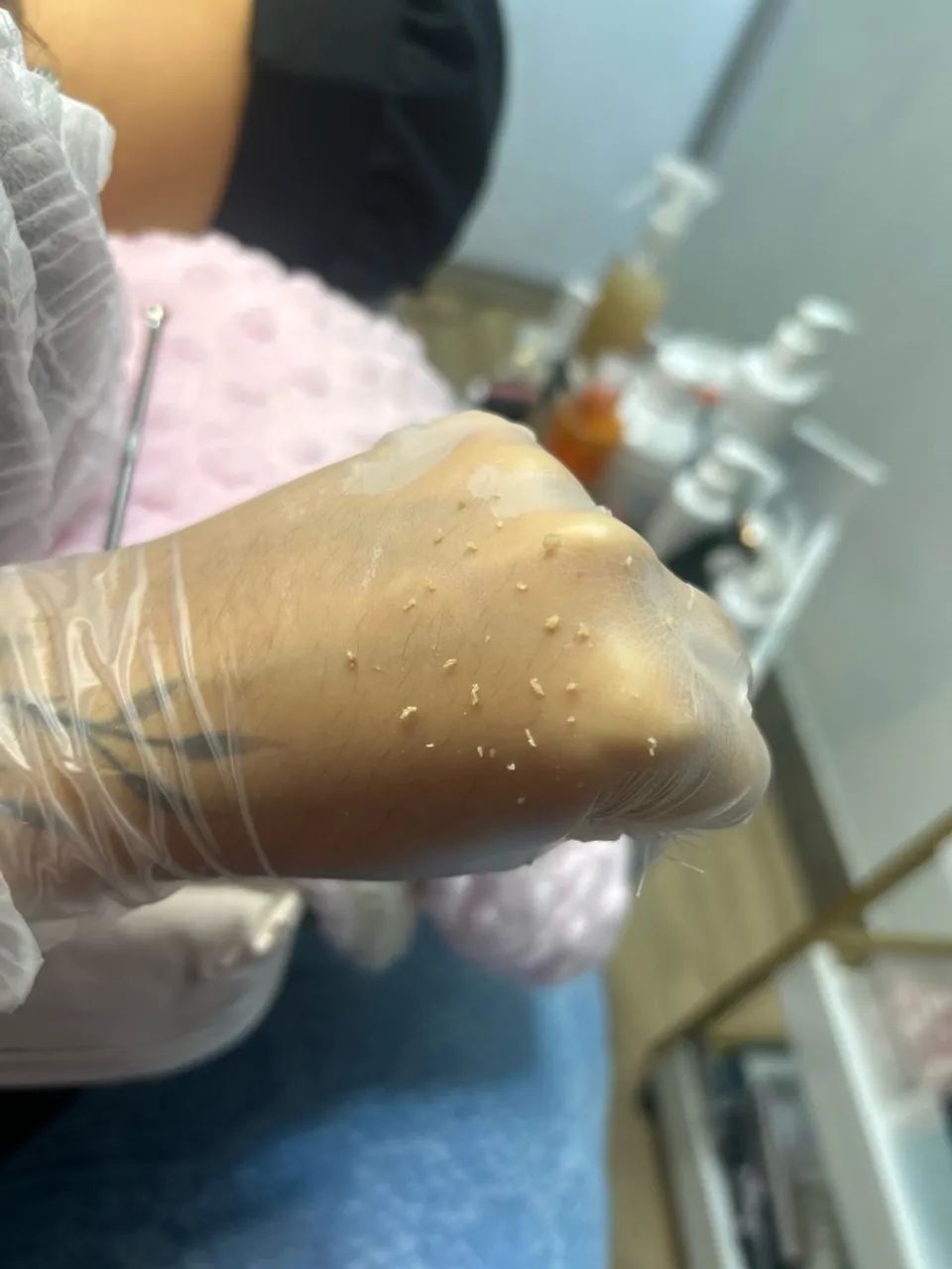 Limpeza de pele completa e personalizada  - Foto 3