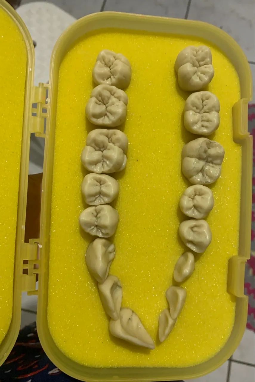 Macro dentes PRONEW - Estojo com 16 dentes  - Foto 2
