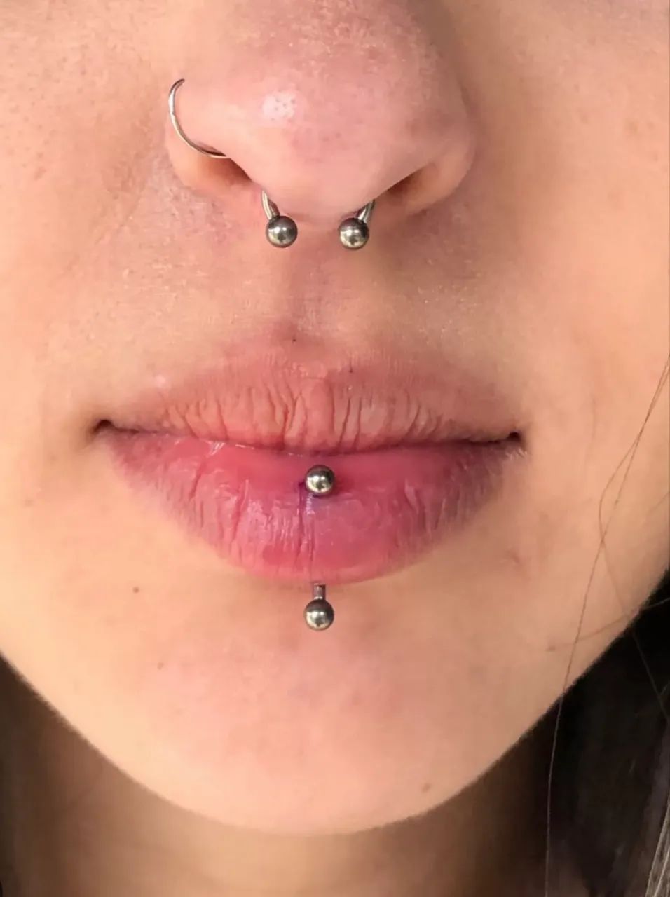 Perfuração de nariz  - Foto 2