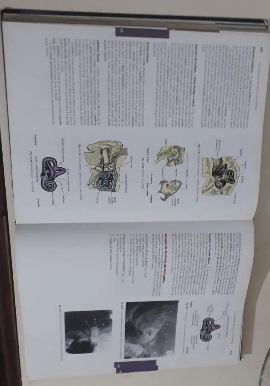 Livro Tratado De Técnica Radiológica E Base Anatomica (Usado) - Foto 2