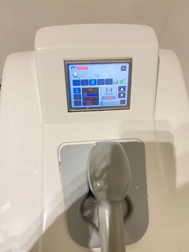 Depilação a laser - Milesman premium  - Foto 3