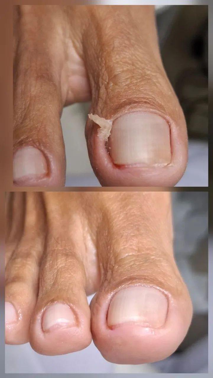 Serviço de podologia domiciliar e clínica  - Foto 5