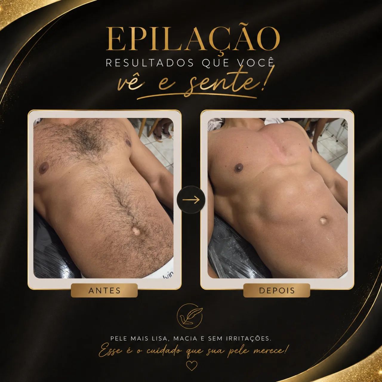 Depilação com cera - Foto 3
