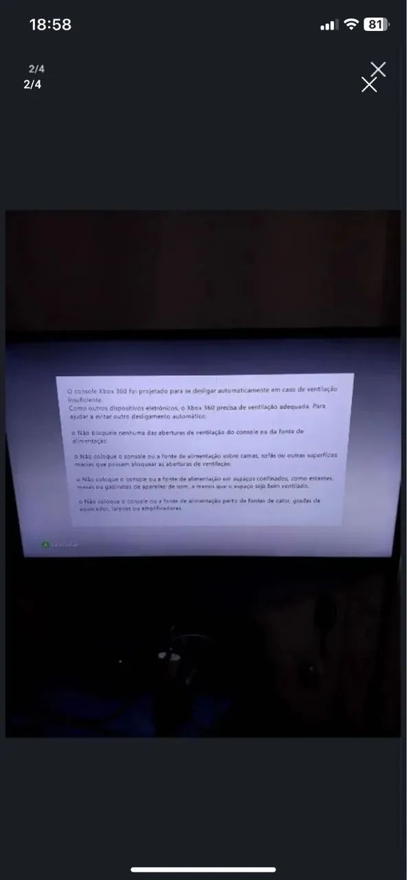 X box
