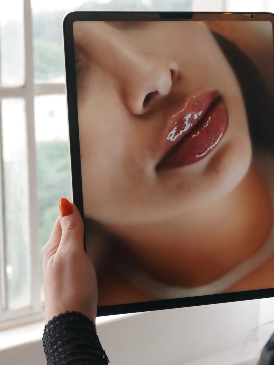 PREENCHIMENTO LABIAL  - Foto 4