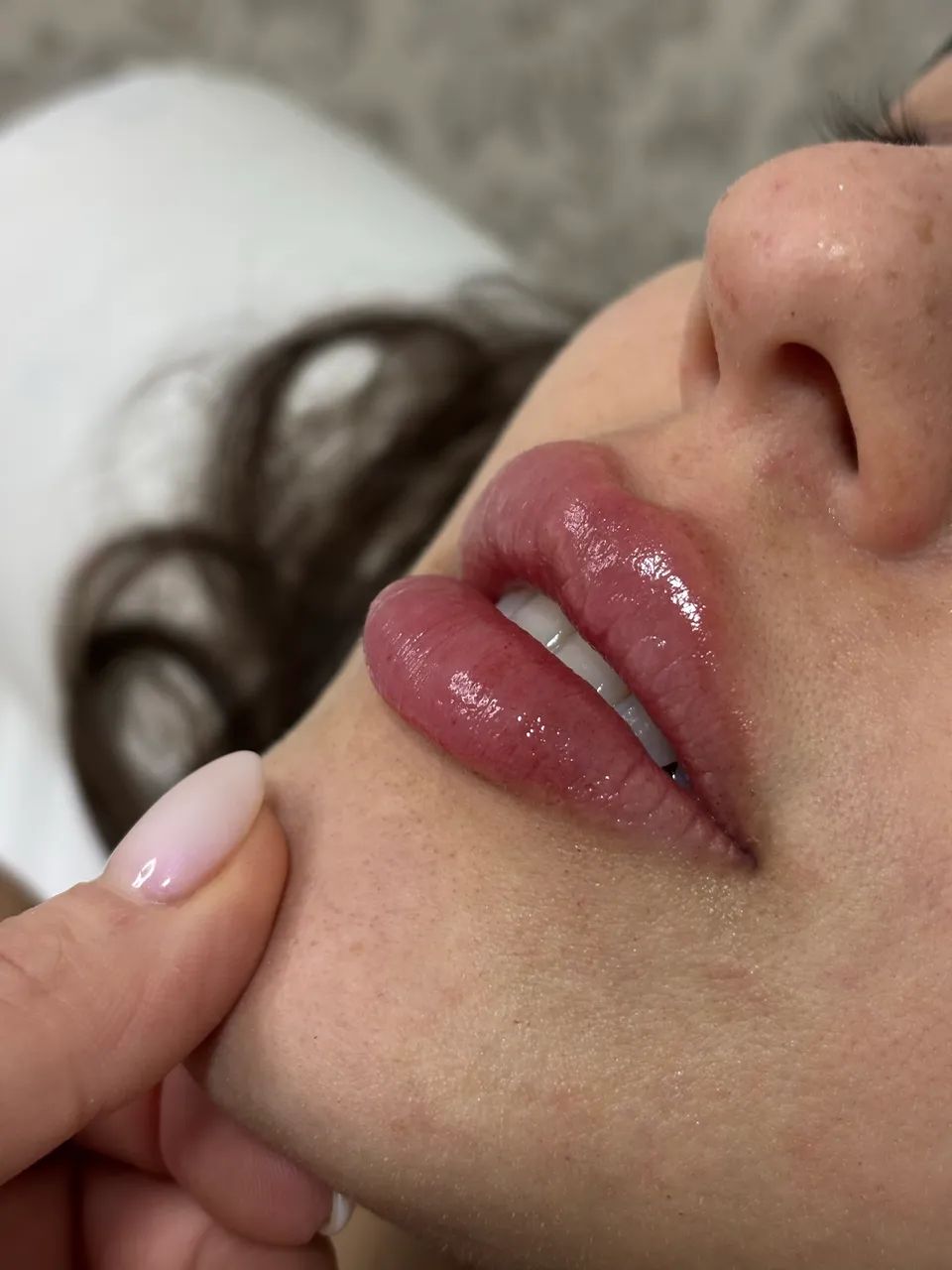 PREENCHIMENTO LABIAL 