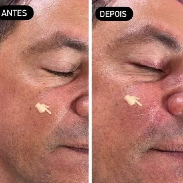 Preenchimento do Bigode Chinês 