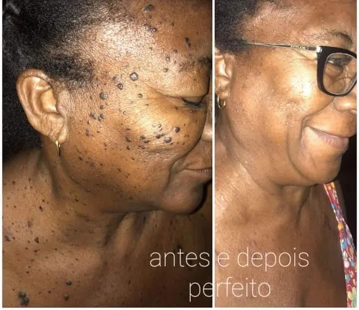 Retirada retirada de sinais - Foto 3