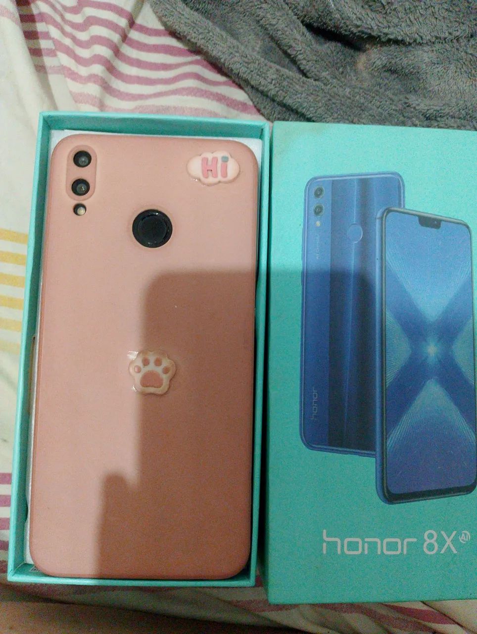 CELULAR PRONTO PRA USO  - Foto 2