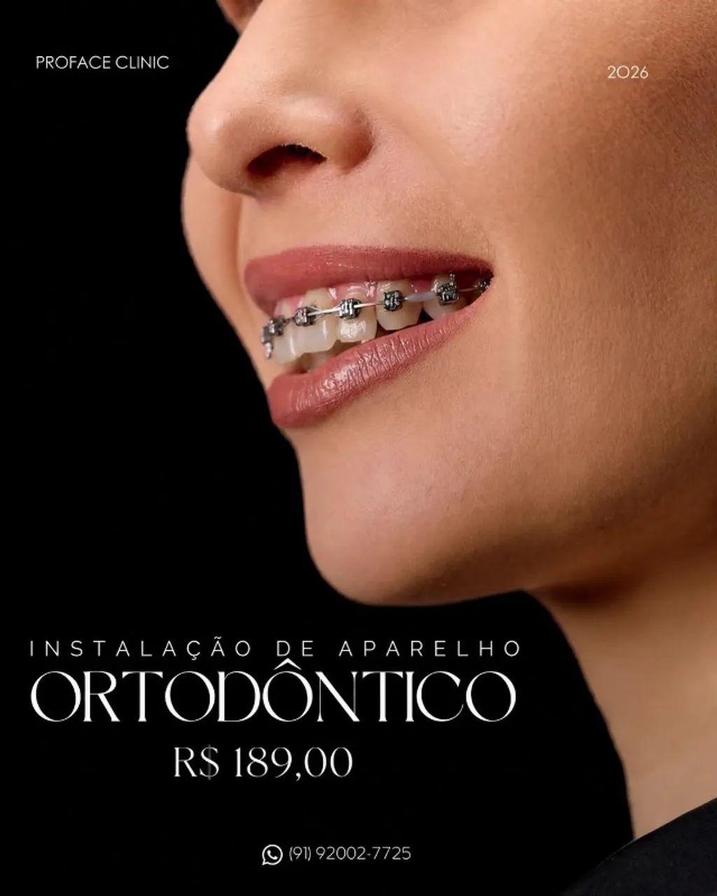 APARELHO ORTODONTICO