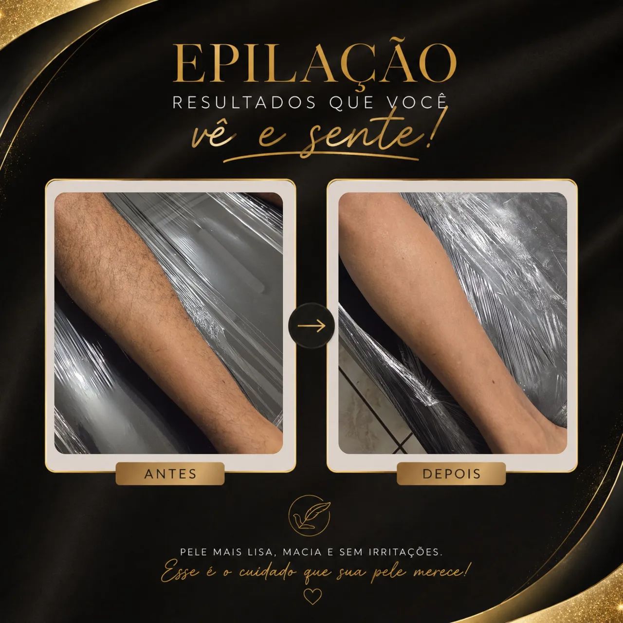 Depilação com cera - Foto 4