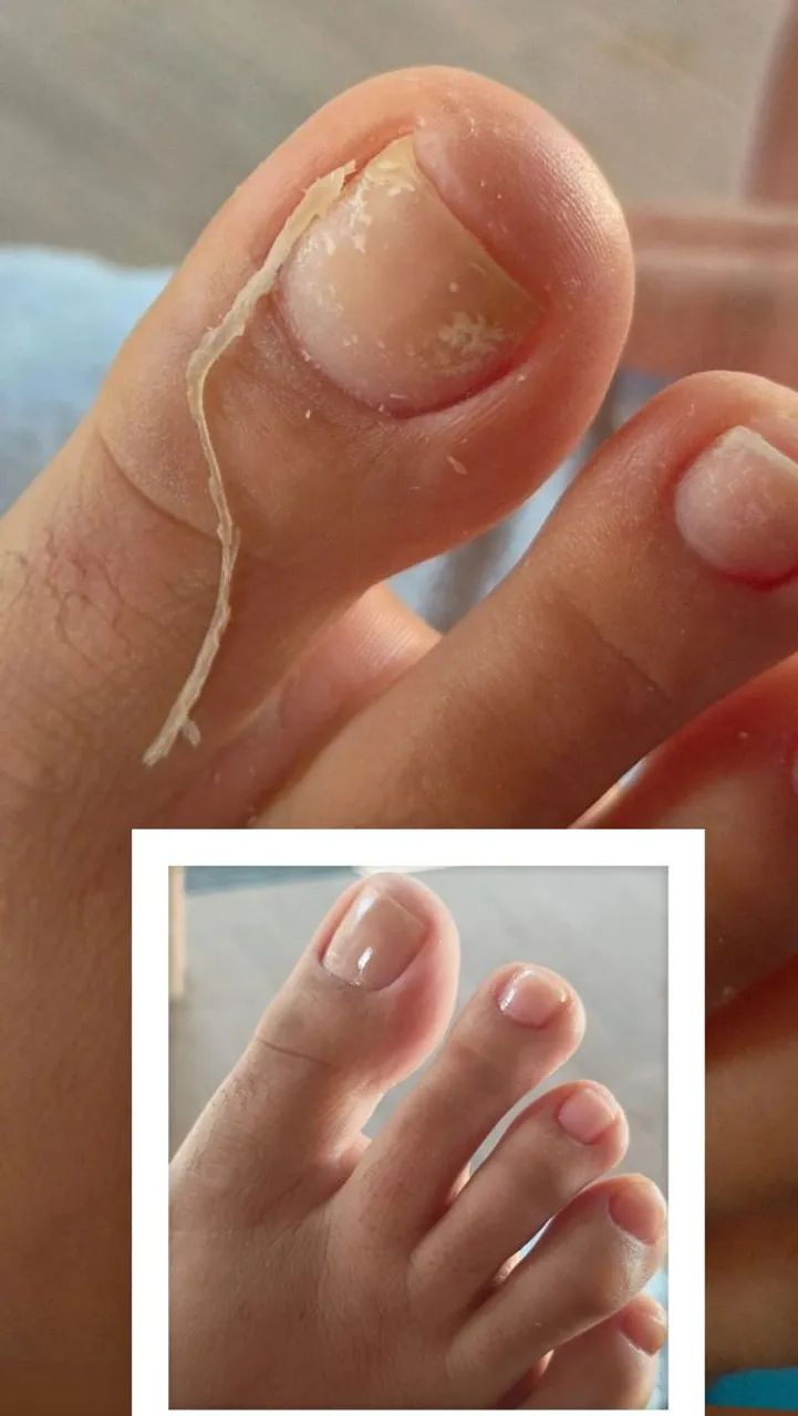 Manicure e pedicure  - Foto 3