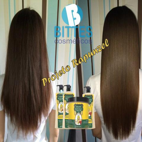 5 Kits Tratamento Capilar Biotônico Cresce Cabelo Hot Bittes Cosméticos - Foto 5