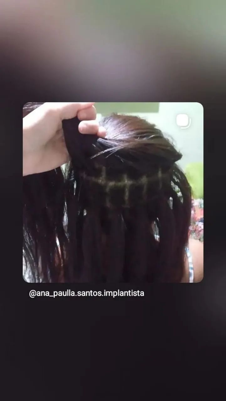 Implante Mega hair. - Foto 2