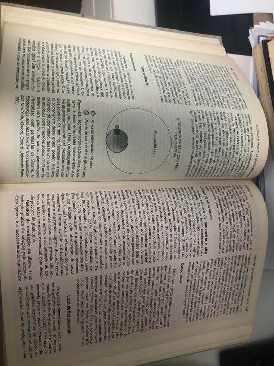 Livro: Glaucoma - Editora Panamericana - Foto 2