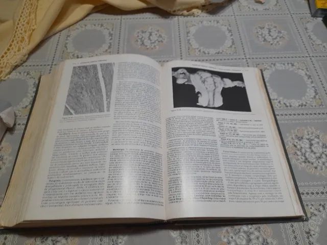 livro: patologia estrutural e funcional - robbins - otimo estado - Foto 5