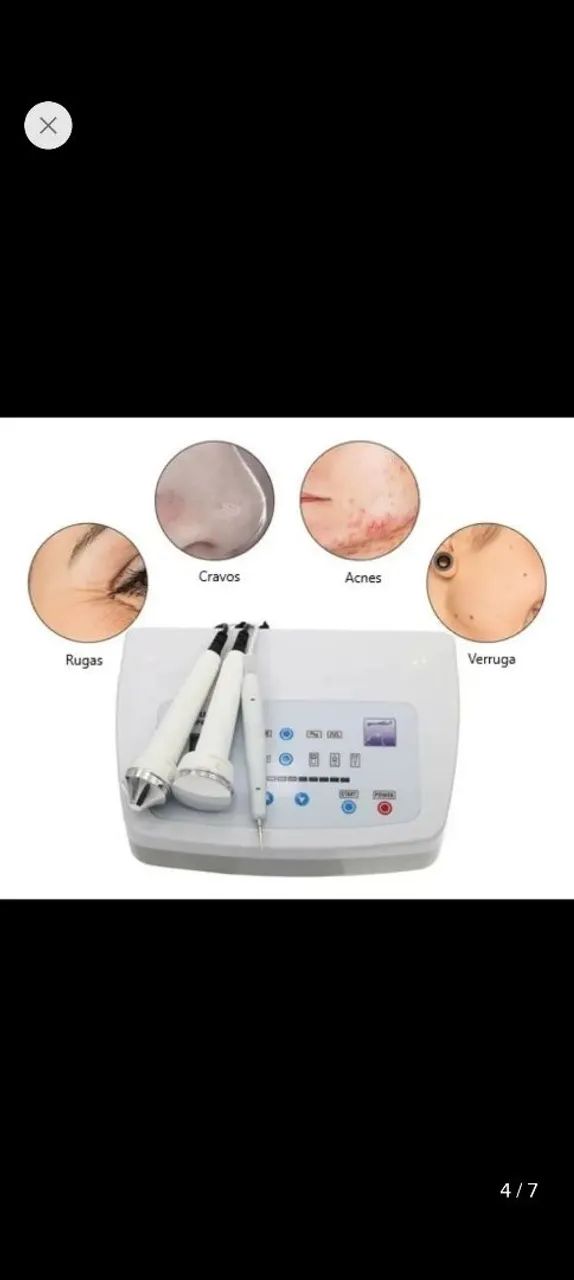 jato plasma - Foto 5