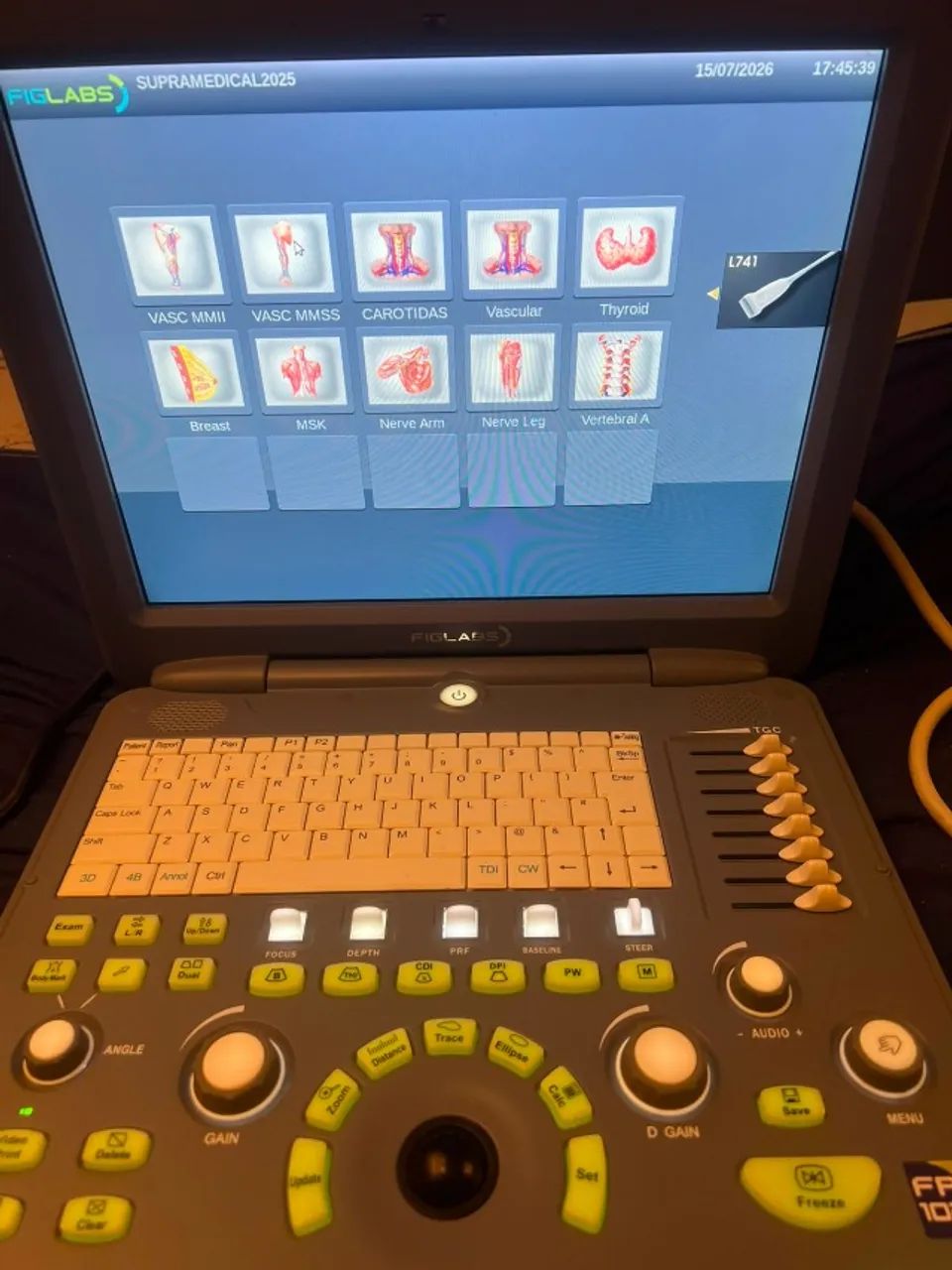 Ultrassom Portátil Doppler Colorido ano 2019