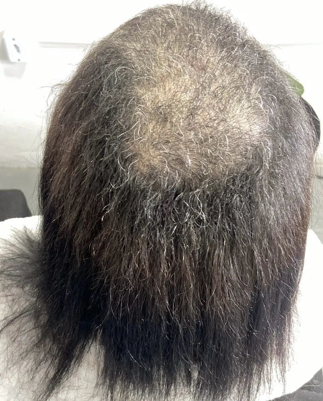 Mega hair  - Foto 3