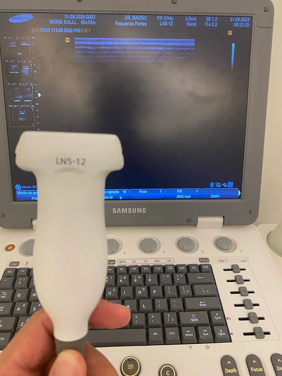 Aparelho de Ultrassom Samsung U6 - Foto 2