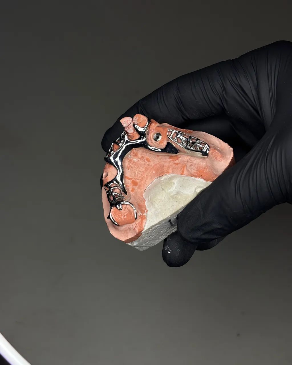 PPR. Prótese Parcial Removível Metálica - Foto 4