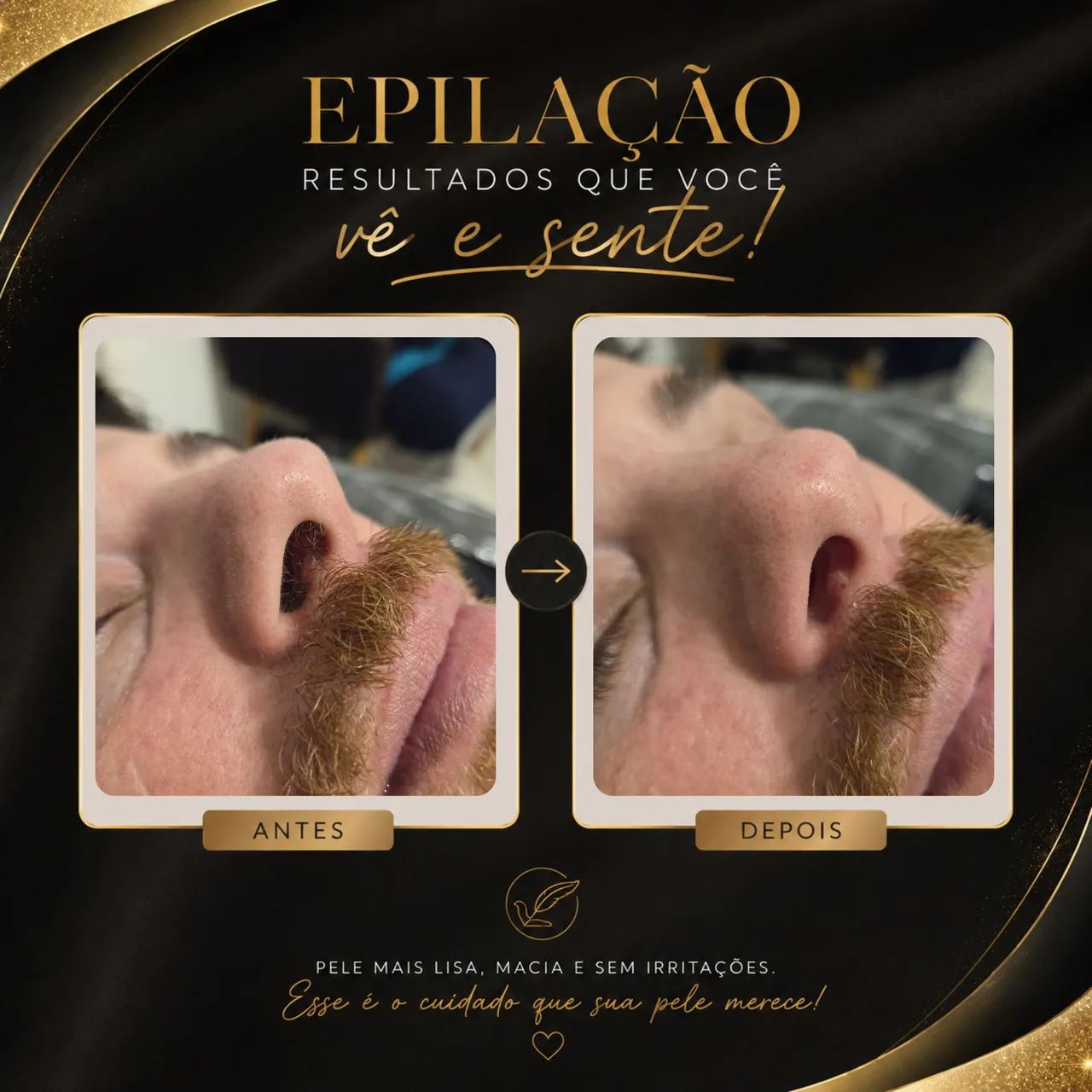 Depilação com cera - Foto 5