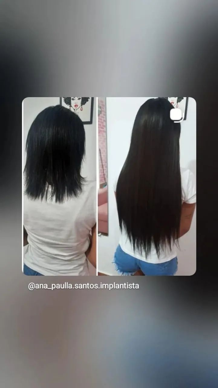 Implante Mega hair. - Foto 3