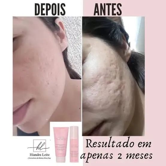 Produtos Mary Kay - Foto 2