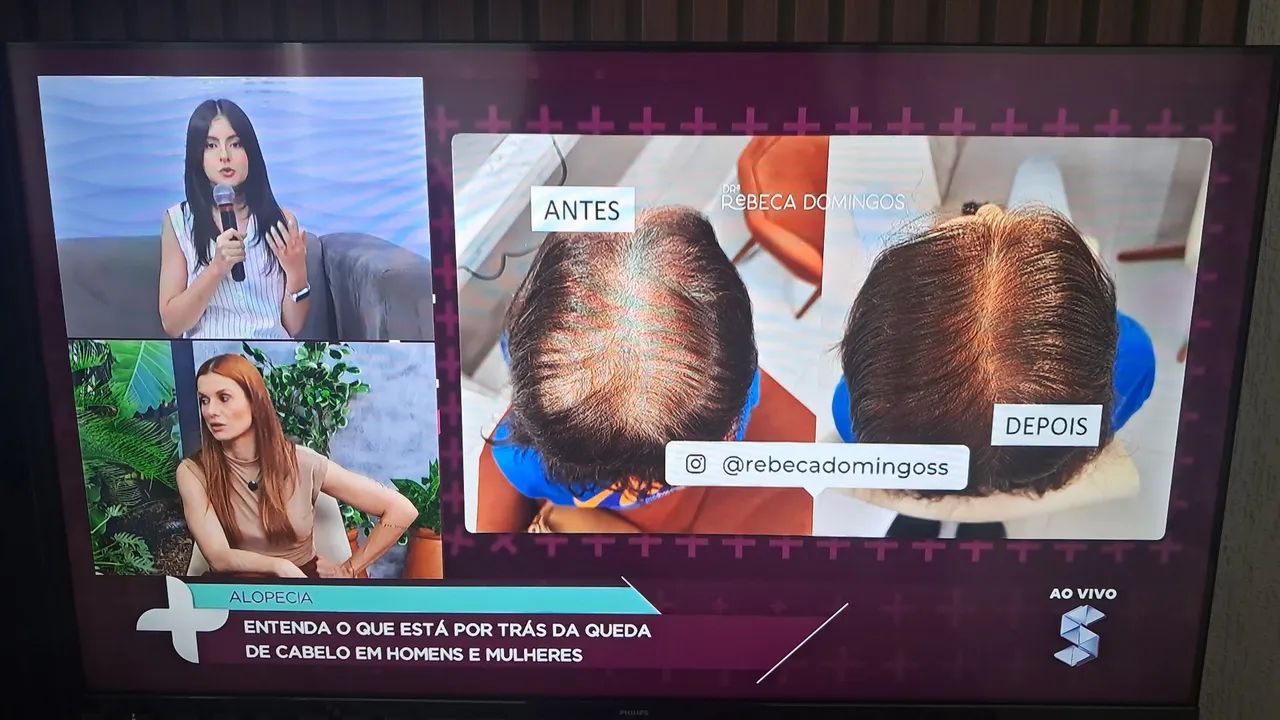 SMART TV PHILIPS 43 POLEGADAS NA CAIXA,  SUPER NOVA.  - Foto 4