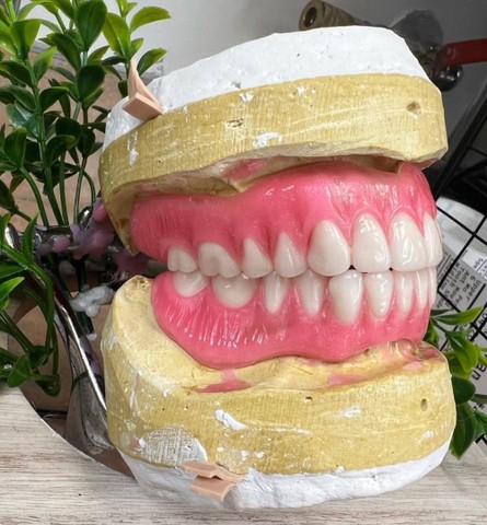 Chapa dentadura próteses dentária bride  - Foto 3