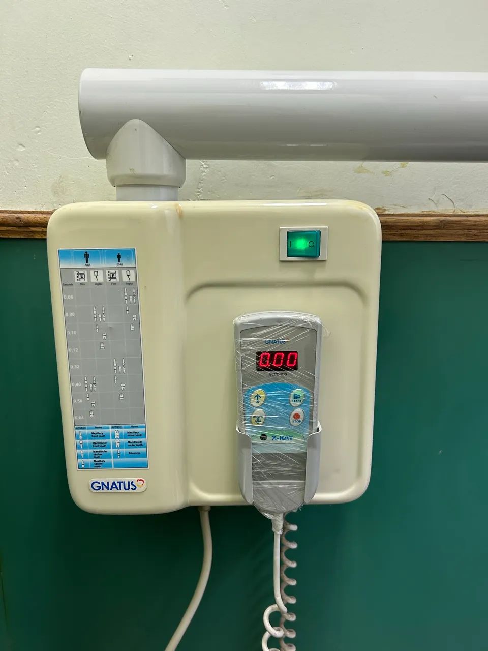 Gnatus Fixed Dental X-ray Machine
