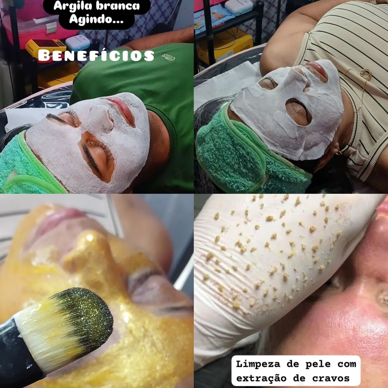 Limpeza de pele com extração 