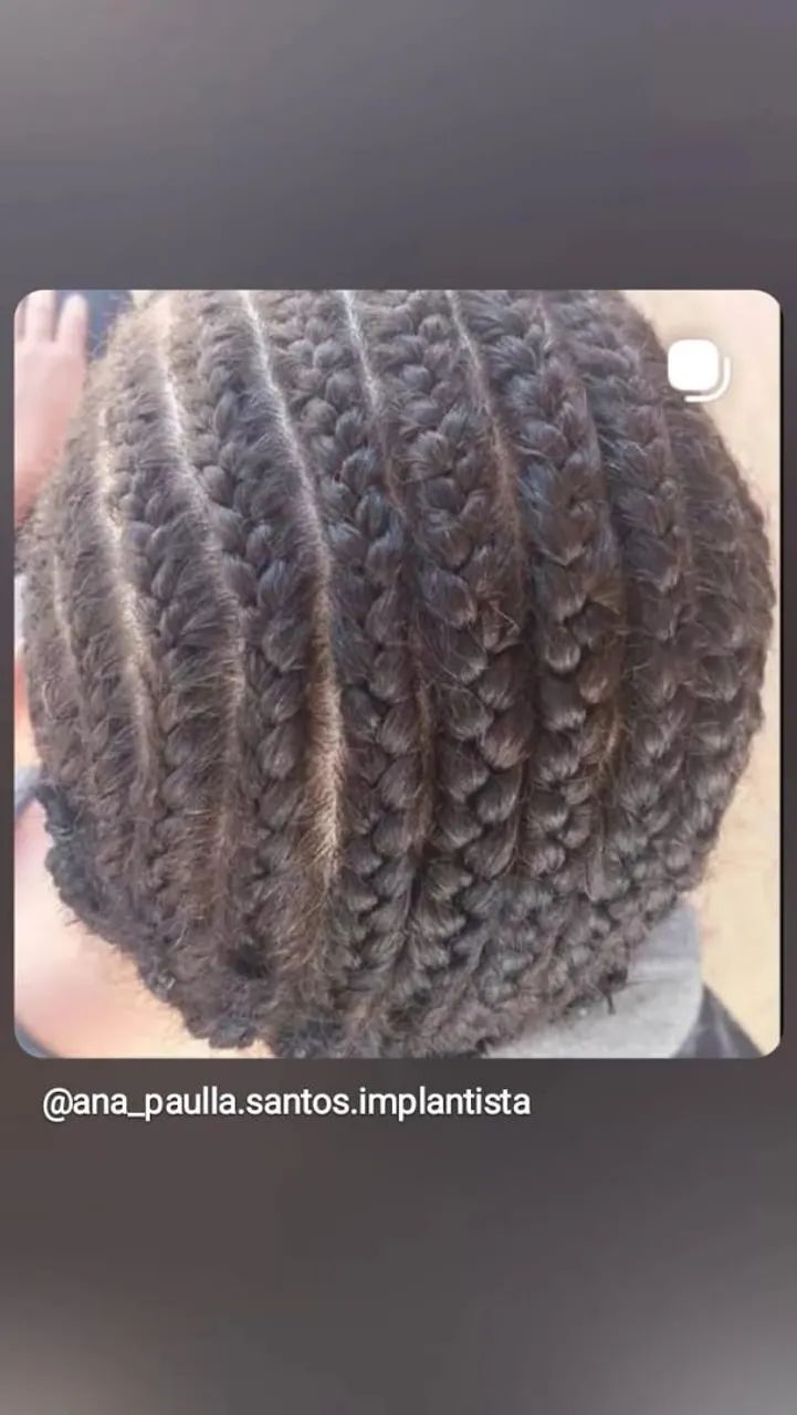 Implante Mega hair. - Foto 4