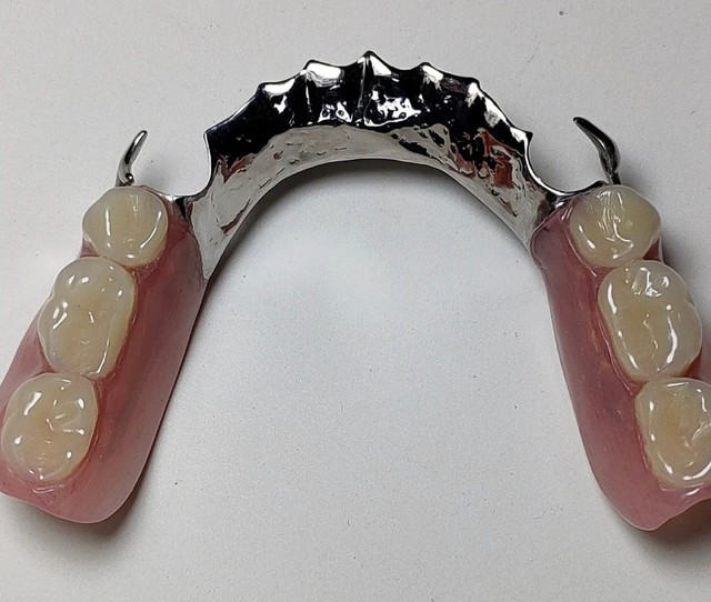 Chapa dentadura próteses dentária bride 