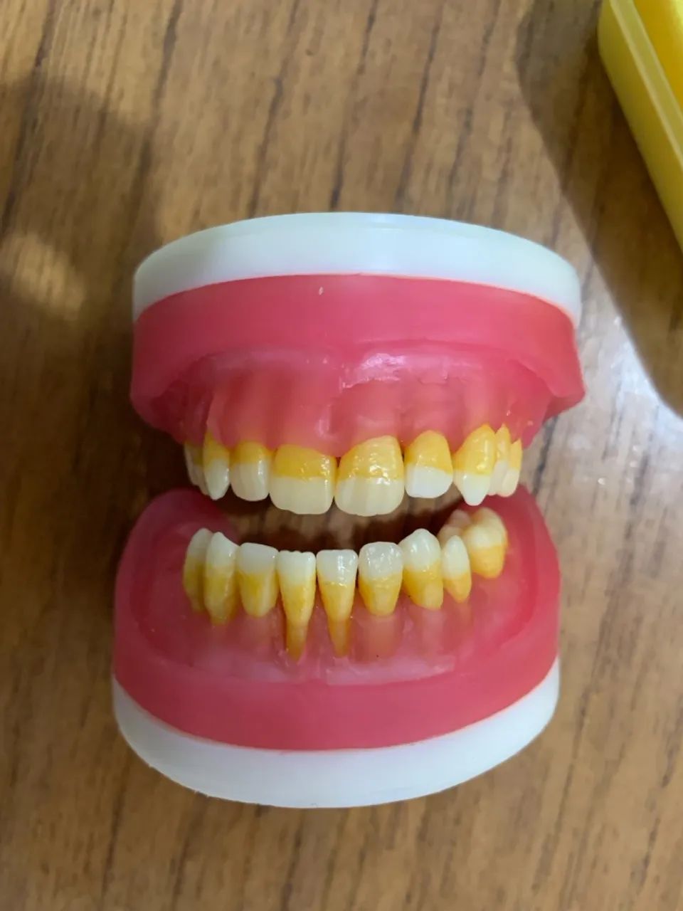 Refil manequim Cirurgia com Dentes de Periodontia - Foto 2