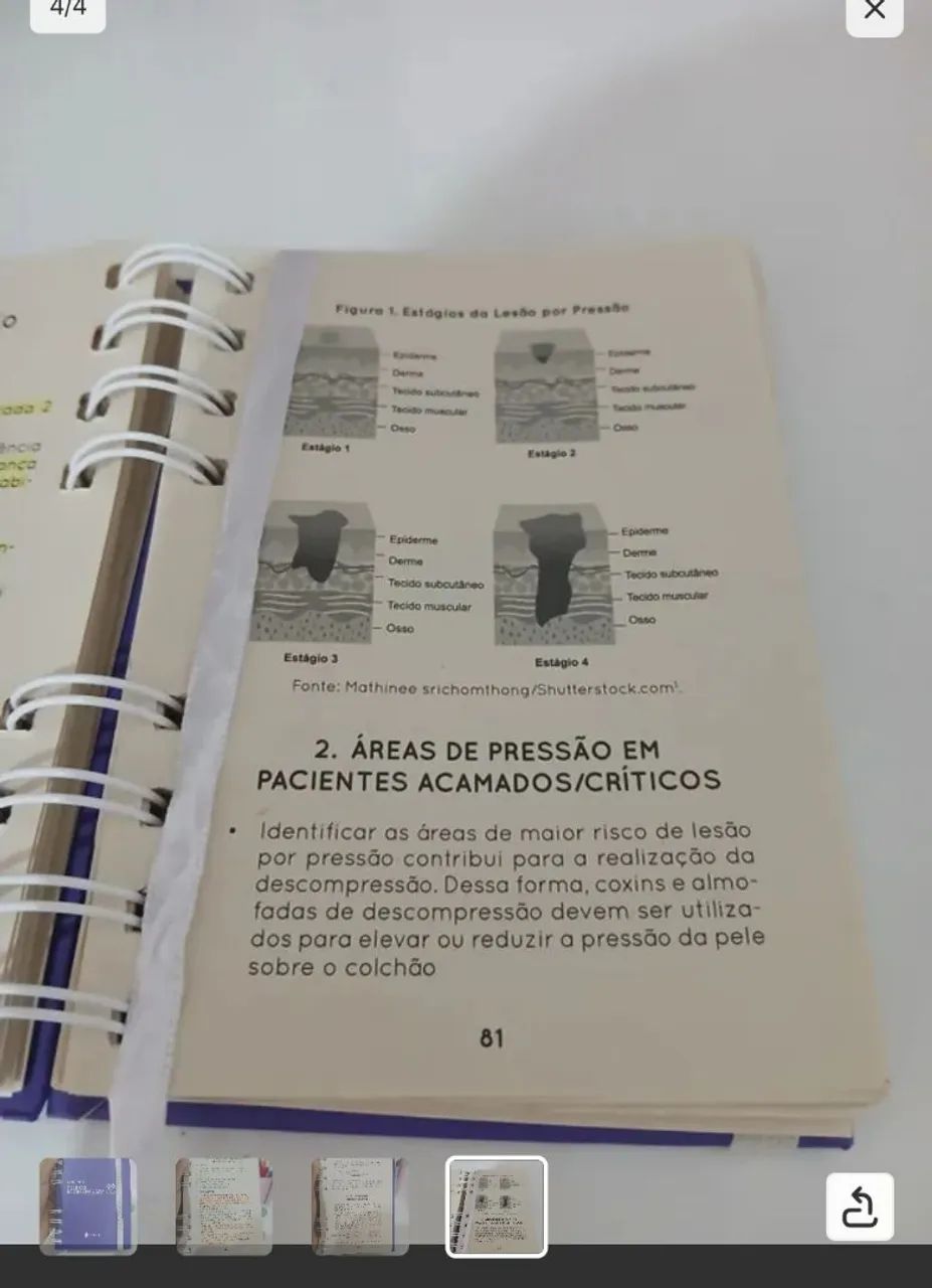 Livro de enfermagem Sanar Note - Foto 5