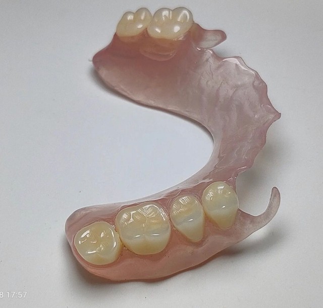 Chapa dentadura próteses dentária bride  - Foto 2