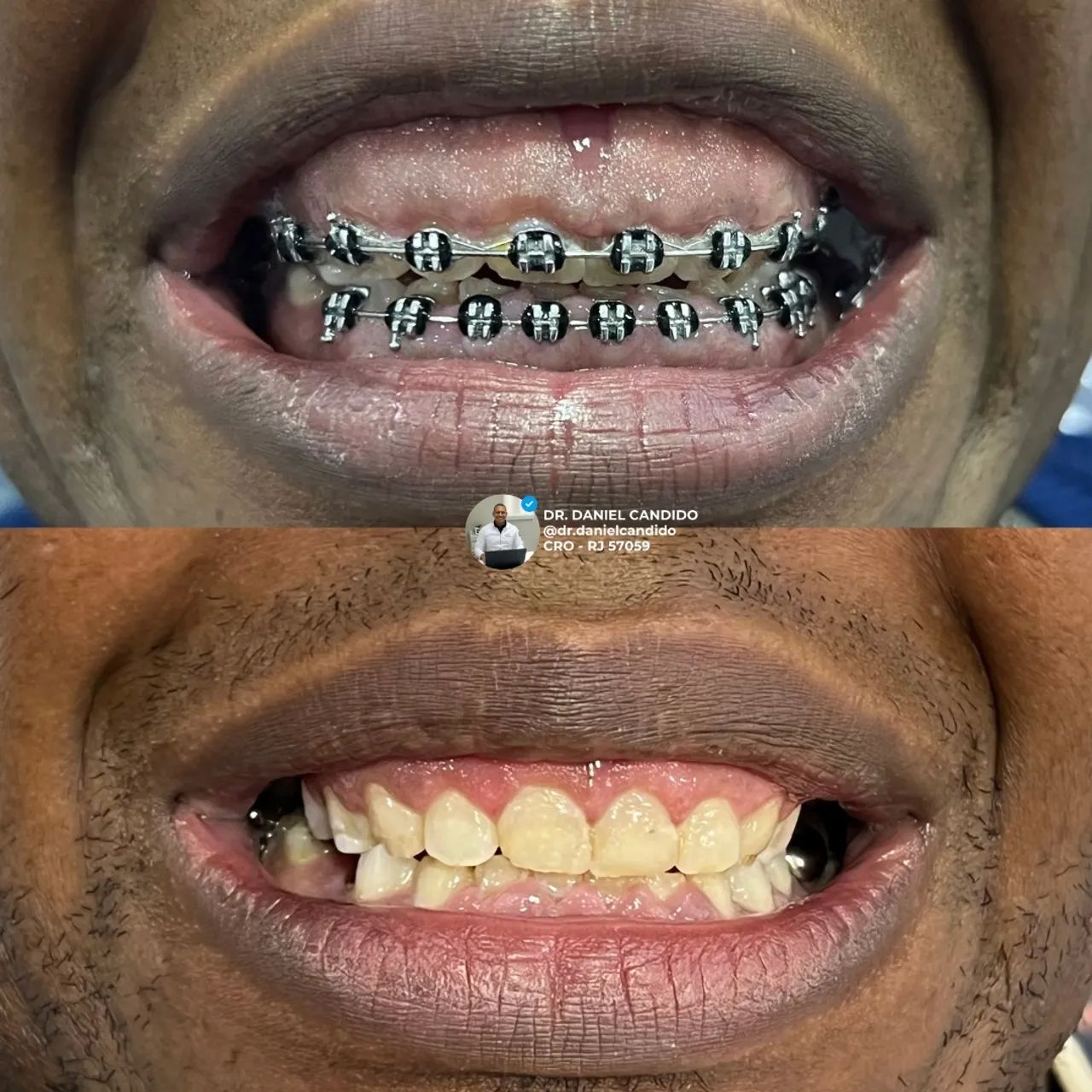 Serviços odontológicos  no engenho novo  - Foto 2